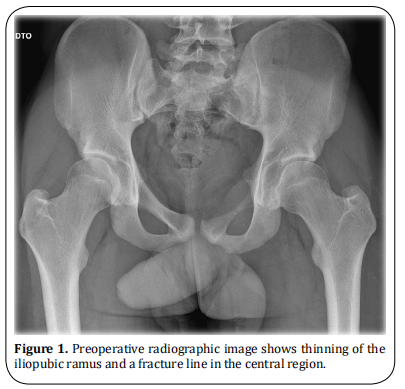 Figure 1.  